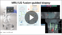 1. 前立腺癌に対するMRI/US fusion-guided biopsy「泌尿器科医の立場から」